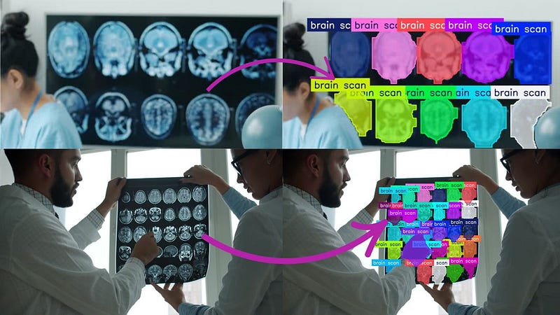 How Computer Vision Is Transforming Medical Imaging Analysis
