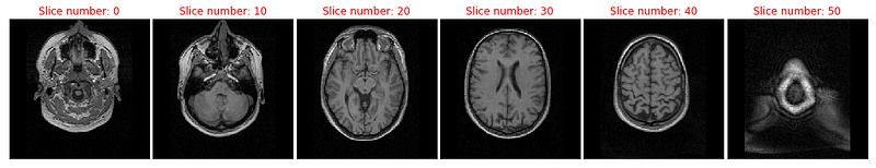 Mri Data Python Visualizing Brain Imaging Data (fMRI) with Python